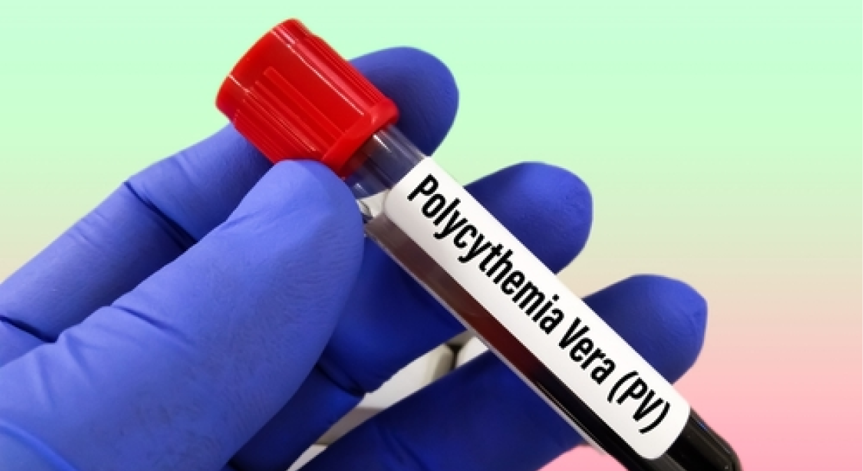 Protagonist And Takeda Report Positive Phase 3 Results For Rusfertide In Polycythemia Vera